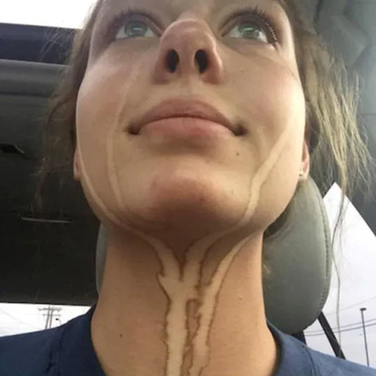 Avant après bronzage